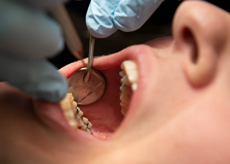 Exploring The Field Of Restorative Dentistry With A General Dentist Restorative Dentistry
